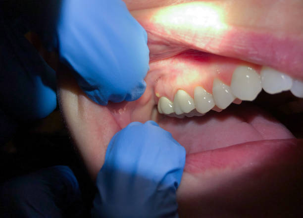 Best Mobile Emergency Dentist in Kenneth City, FL